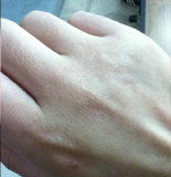 第十期:秋冬护手困扰j9平台救救我的脸(图3) 第十期:秋冬护手困扰j9平台救救我的脸(图3)